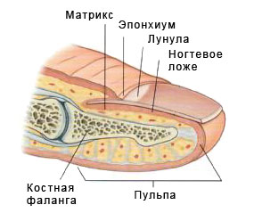 Лечение вросшего ногтя